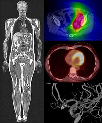 Radiologie Lehre Röntgen-Aufnahmen