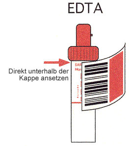 Laboranforderung Röhrchen Probe mit Etikett EDTA