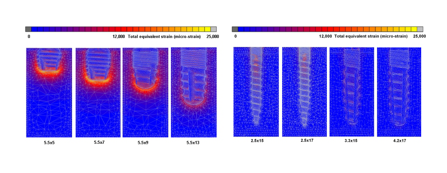 Grafik Spannungsverteilung im Implantat