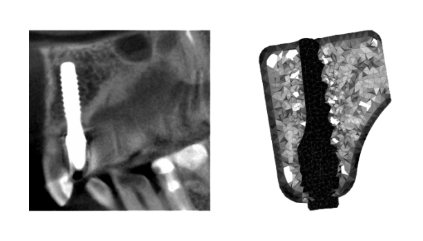 Bone-Remodelling Röntgenaufnahme und Grafik