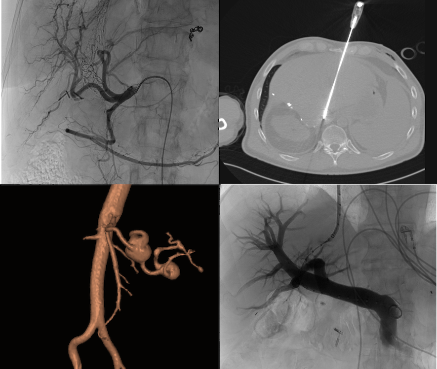 Aufnahme AG Interventionelle Radiologie