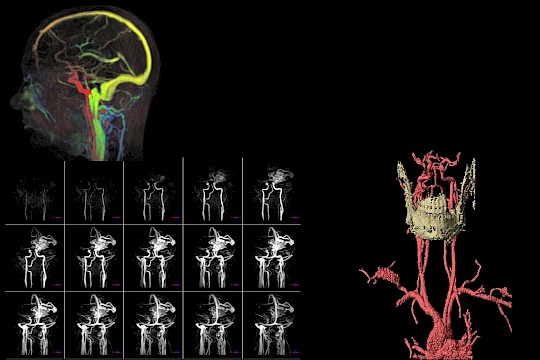 Neurovaskuläre Bildgebung