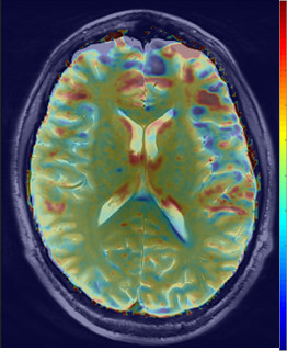 Neuroonkologische Bildgebung