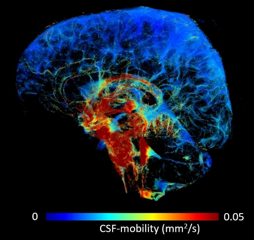 Brain Clearance Imaging