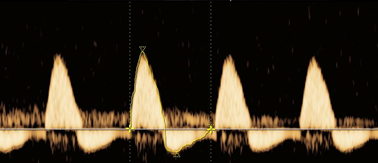 Dopplersonographie