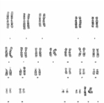 Chorionzottenbiopsie