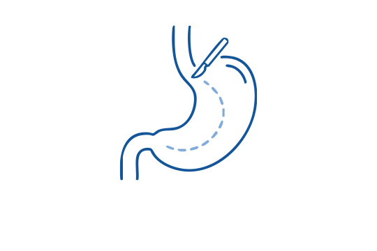 Chirurgie Icon Gastrointestinaltrakts