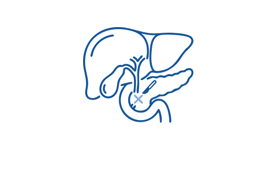 Chirurgie Icon Gallenweg