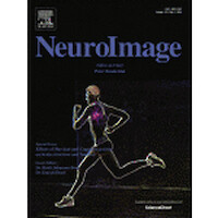 Effects Of Physical And Cohnitive Activity