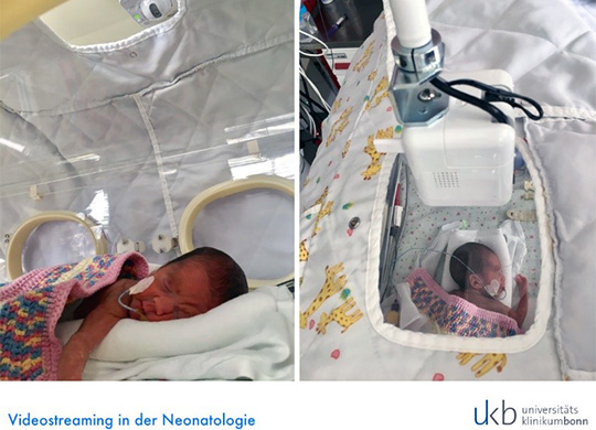 Videostreaming in der Neonatologie